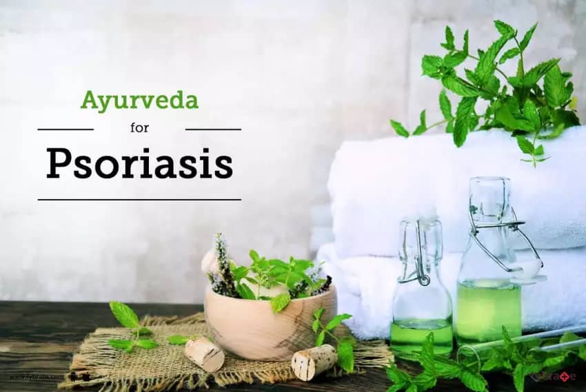 psoriasis ayurvedic treatment
